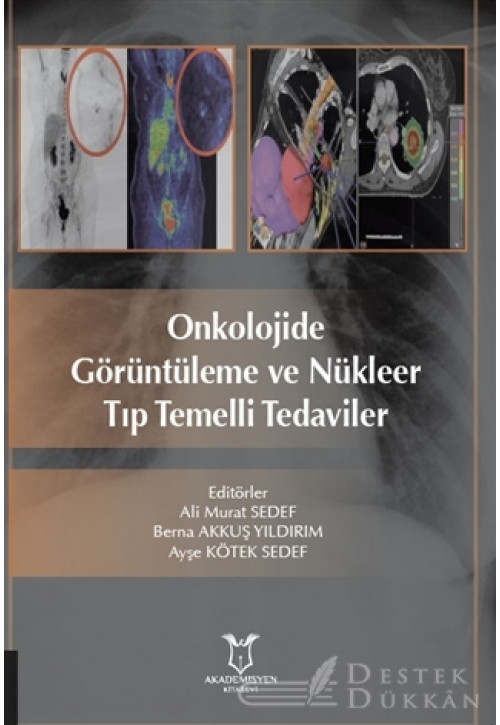 Onkolojide Görüntüleme ve Nükleer Tıp Temelli Tedaviler